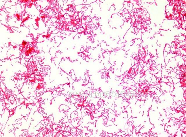 Vi khuẩn Gram âm có sắc hồng hoặc đỏ
